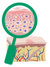 Vista ampliada de las células de la piel en pacientes tratados con Dupixent® (dupilumab) para el eczema moderado a grave no controlado (dermatitis atópica)